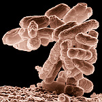 Bakterie Escherichia coli, 10000x zvětšeno
